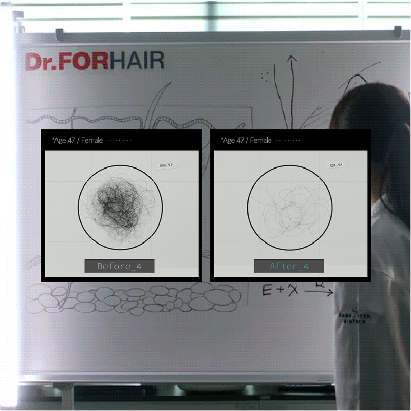 Dr.FORHAIR Bio-3 Folligen Shampoo 3